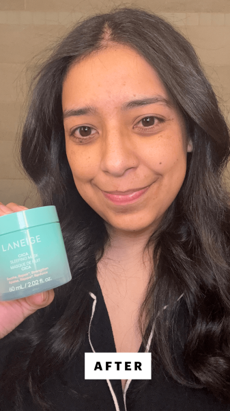 Foresto after applying the Laneige Cica Sleeping Mask